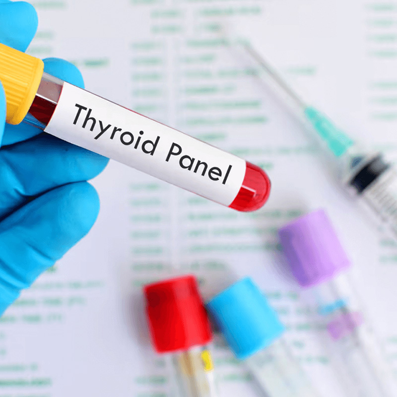 Blood sample for thyroid panel test